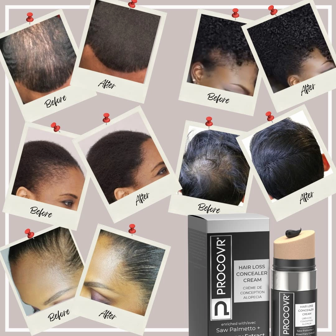 The ORIGINAL Thinning Hair and Hairline Concealer, Natural Hair Mascara for Balding Areas, Root Touch-Up for Thicker Appearance (Natural Brown FBA)